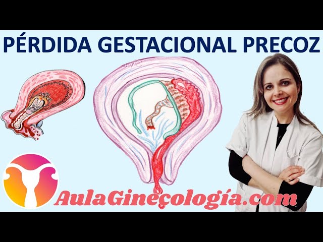 como saber si el aborto fue completo