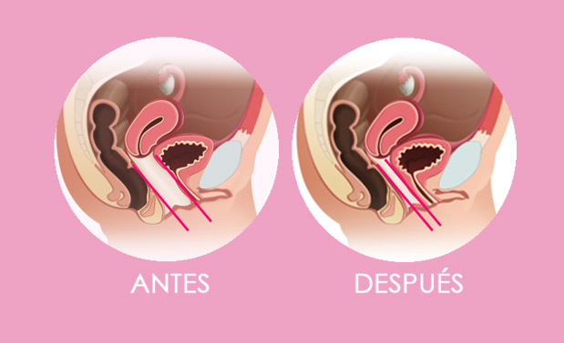 como saber si estoy muy abierta